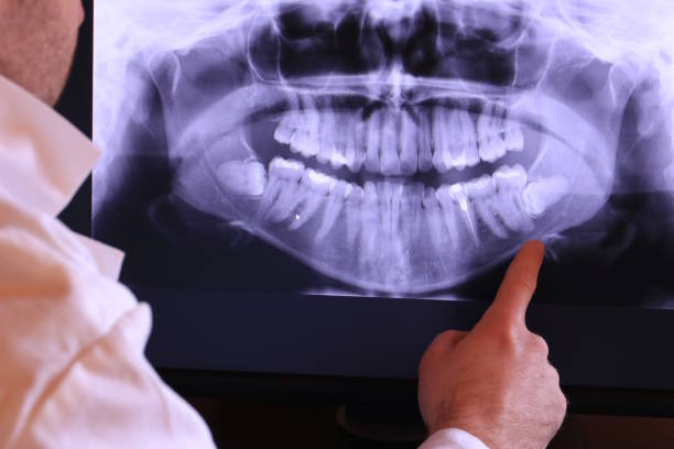 Best Emergency Dentist for Lost Fillings or Crowns in Winner, SD