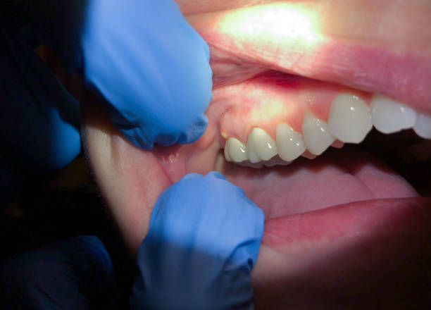 Best Emergency Dentist for Special Needs Patients in Winner, SD