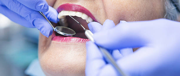 Best Emergency Dental Extractions in Winner, SD